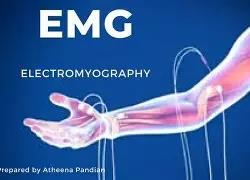 Electromyography