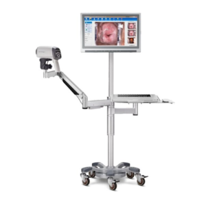 Colposcope