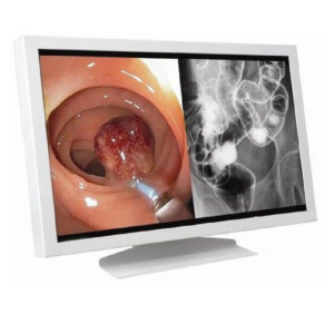 Medical Grade Monitor